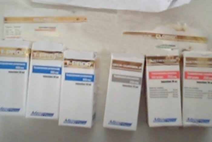 15.02.18 Versailles, Francia